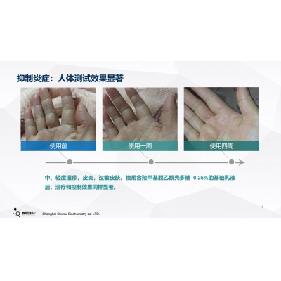 羧甲基脱乙酰壳多糖